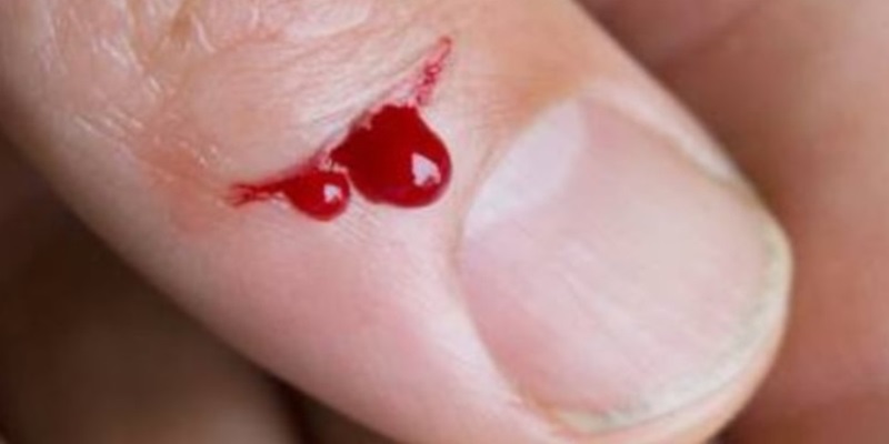 Đánh số gì khi mơ thấy đứt tay chảy máu