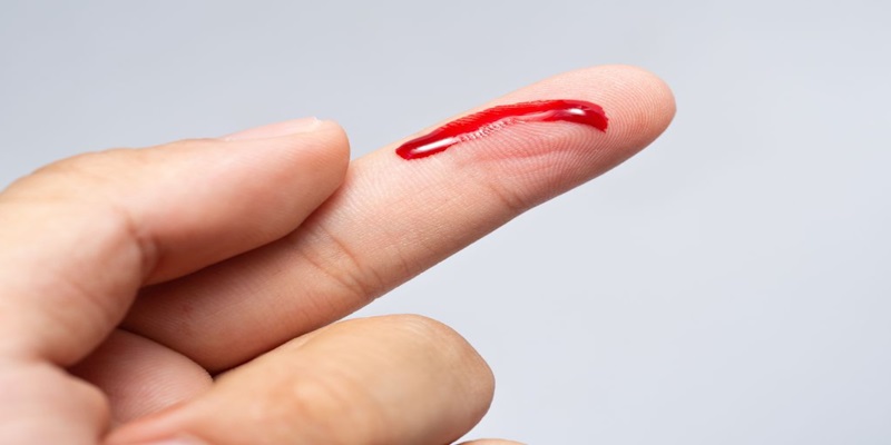 Mẹo đánh lô đề hiệu quả khi mơ thấy máu đánh con gì